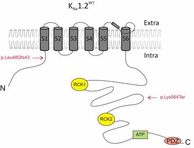 The Epilepsy of Infancy With Migrating Focal Seizures: Identification of de novo Mutations of the KCNT2 Gene That Exert Inhibitory Effects on the Corresponding Heteromeric KNa1.1/KNa1.2 Potassium Channel